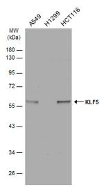 KLF5 Antibody in Western Blot (WB)