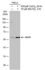 KLF5 Antibody in Western Blot (WB)