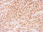 RAD54B Antibody in Immunohistochemistry (Paraffin) (IHC (P))