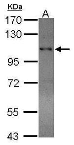 RAD54B Antibody in Western Blot (WB)