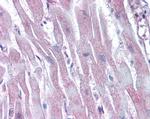 Arp2 Antibody in Immunohistochemistry (Paraffin) (IHC (P))