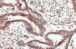 Nrf2 Antibody in Immunohistochemistry (Paraffin) (IHC (P))