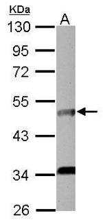 IL5RA Antibody in Western Blot (WB)