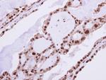 RAD23B Antibody in Immunohistochemistry (Paraffin) (IHC (P))