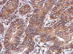 ACVR1C Antibody in Immunohistochemistry (Paraffin) (IHC (P))