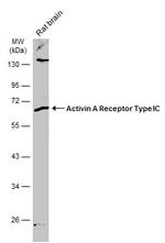 ACVR1C Antibody in Western Blot (WB)