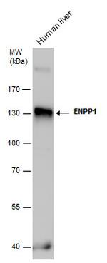 ENPP1 Antibody in Western Blot (WB)