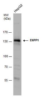 ENPP1 Antibody in Western Blot (WB)