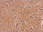 Monoacylglycerol Lipase Antibody in Immunohistochemistry (Paraffin) (IHC (P))