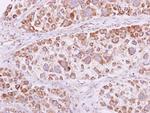 PSKH1 Antibody in Immunohistochemistry (Paraffin) (IHC (P))