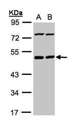 PSKH1 Antibody in Western Blot (WB)