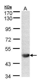 ALG1 Antibody in Western Blot (WB)