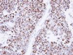 ECH1 Antibody in Immunohistochemistry (Paraffin) (IHC (P))