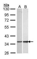 ECH1 Antibody in Western Blot (WB)