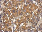 Complement Factor B Antibody in Immunohistochemistry (Paraffin) (IHC (P))