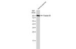 Complement Factor B Antibody in Western Blot (WB)