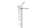 Complement Factor B Antibody in Western Blot (WB)