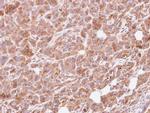 GNAI3 Antibody in Immunohistochemistry (Paraffin) (IHC (P))