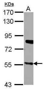CYP27A1 Antibody in Western Blot (WB)