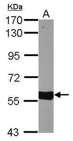 CYP27A1 Antibody in Western Blot (WB)