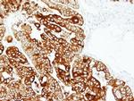 Cytokeratin 17 Antibody in Immunohistochemistry (Paraffin) (IHC (P))