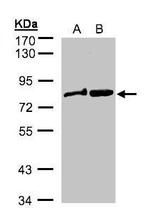 DVL2 Antibody in Western Blot (WB)