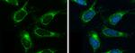 OAT Antibody in Immunocytochemistry (ICC/IF)