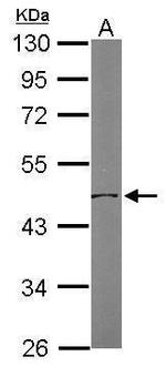 OAT Antibody in Western Blot (WB)