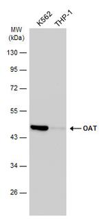 OAT Antibody in Western Blot (WB)