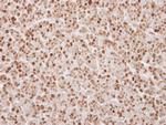 UHRF1 Antibody in Immunohistochemistry (Paraffin) (IHC (P))