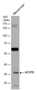 ACOT8 Antibody in Western Blot (WB)