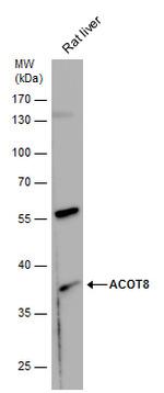 ACOT8 Antibody in Western Blot (WB)