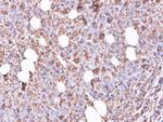 RPS3 Antibody in Immunohistochemistry (Paraffin) (IHC (P))