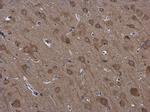 RPS3 Antibody in Immunohistochemistry (Paraffin) (IHC (P))