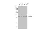 RPS3 Antibody in Western Blot (WB)