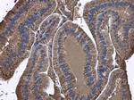 Arginase 2 Antibody in Immunohistochemistry (Paraffin) (IHC (P))