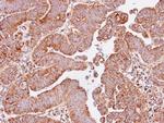 IDH3A Antibody in Immunohistochemistry (Paraffin) (IHC (P))