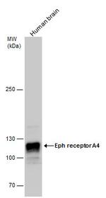 EphA4 Antibody in Western Blot (WB)