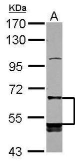 LILRB5 Antibody in Western Blot (WB)