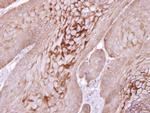 Kallikrein 11 Antibody in Immunohistochemistry (Paraffin) (IHC (P))