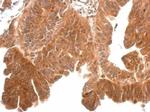 Kallikrein 11 Antibody in Immunohistochemistry (Paraffin) (IHC (P))