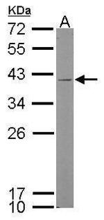 Kallikrein 11 Antibody in Western Blot (WB)