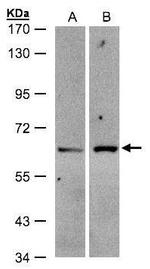 ZSCAN5 Antibody in Western Blot (WB)