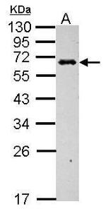 C4BPB Antibody in Western Blot (WB)