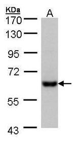 CES2 Antibody in Western Blot (WB)