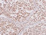 GLI3 Antibody in Immunohistochemistry (Paraffin) (IHC (P))