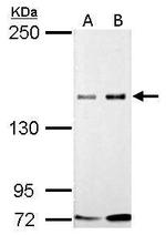 GLI3 Antibody in Western Blot (WB)