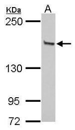 GLI3 Antibody in Western Blot (WB)