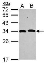 PSMA1 Antibody in Western Blot (WB)