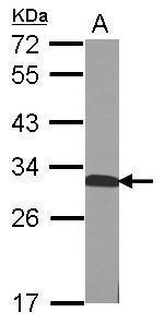 QDPR Antibody in Western Blot (WB)